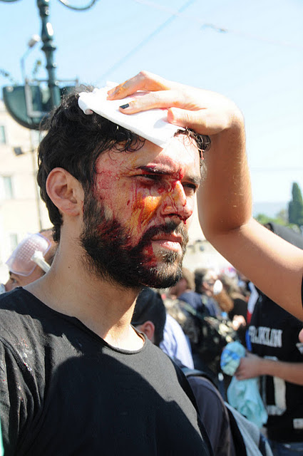 Демонстрант ПАМЕ, раненный камнями. Были ранены по крайней мере 80 демонстрантов, главным образом камнями и обломками мрамора, который провокаторы бросали в толпу демонстрантов